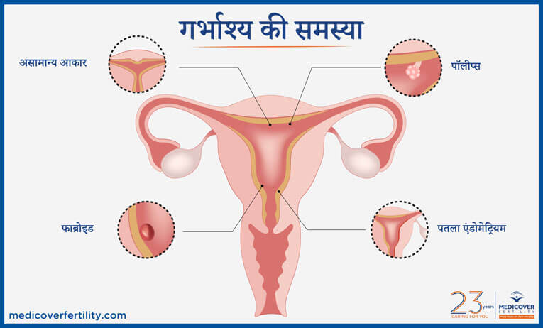 Uterus Problem in Hindi | गर्भाशय से जुडी समस्याएं