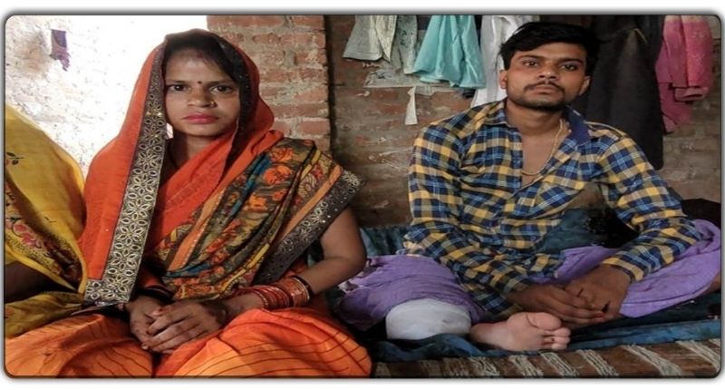 हरदोई की द‍िल छू लेने वाली फ‍िल्‍मी नहीं, सच्‍ची कहानी-हादसे में कटा मंगेतर का पैर फ‍िर भी नहीं छोड़ा साथ